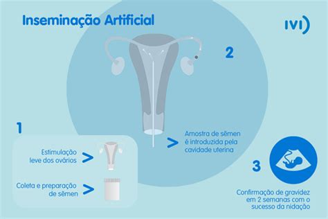 Inseminação artificial (IA) .